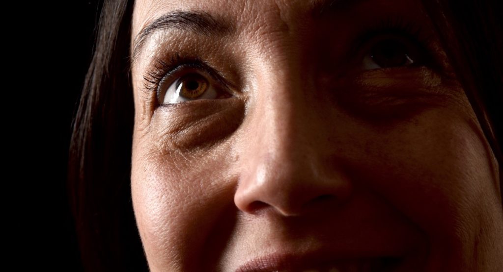 blefaroplastia inferior